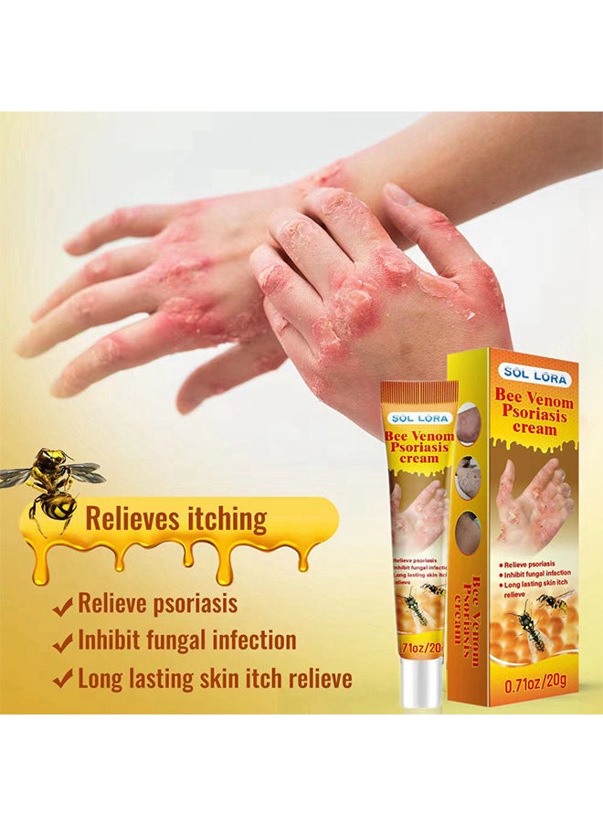 SOL LORA - Bee Venom Psoriasis Cream, New Zealand Bee Venom Professional Psoriasis Cream For Itchy Skin Fast Relief Cream For Face And Body, Soothing And Moisturizing Psoriasis Cream 20G - Image 1