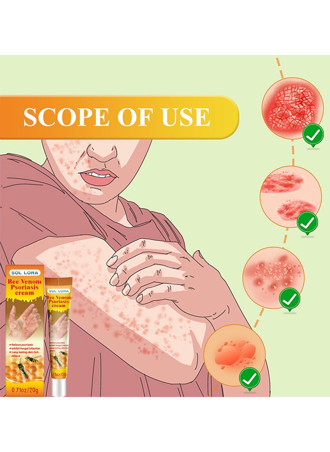 SOL LORA - Bee Venom Psoriasis Cream, New Zealand Bee Venom Professional Psoriasis Cream For Itchy Skin Fast Relief Cream For Face And Body, Soothing And Moisturizing Psoriasis Cream 20G - Image 1