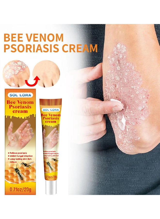 SOL LORA - Bee Venom Psoriasis Cream, New Zealand Bee Venom Professional Psoriasis Cream For Itchy Skin Fast Relief Cream For Face And Body, Soothing And Moisturizing Psoriasis Cream 20G - Image 1