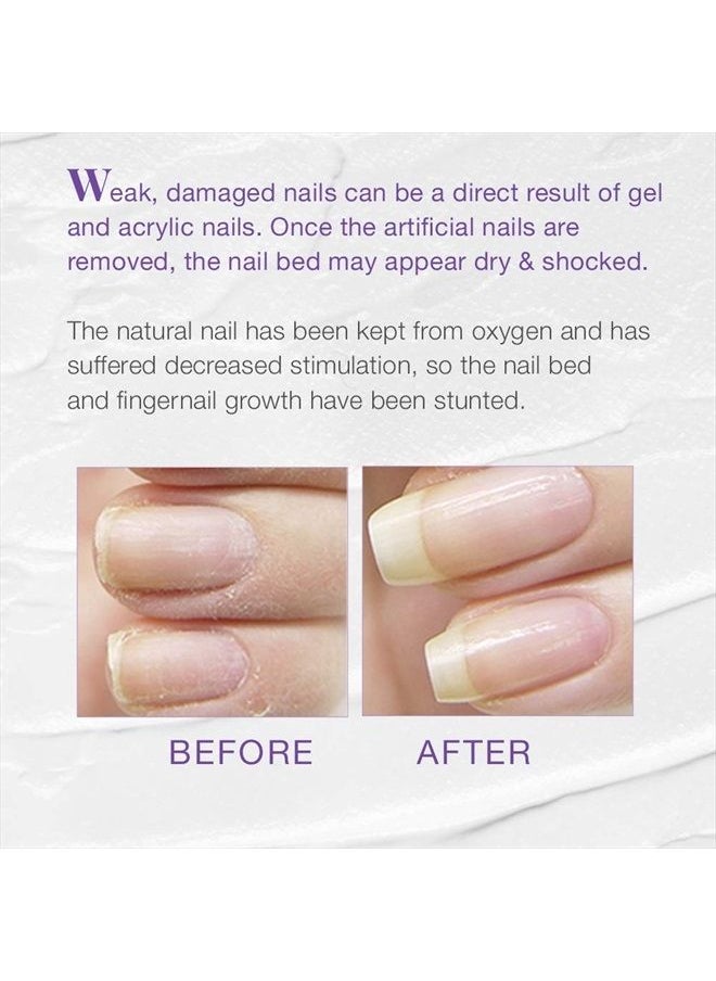 Xtra 4, Nail Strengthener for Weak and Damaged Nails, 0.5 oz, 1-Pack