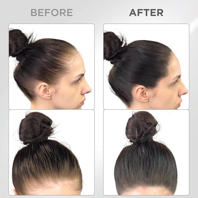 Thick Fiber بودرة تغطية الجذور THICK FIBER لتغطية الرأس الأصلع الرقيق مقاومة للماء والعرق مسحوق شعر للنساء ذوات الشعر الرقيق تشمل فرشاة 4 جرام - Image 4