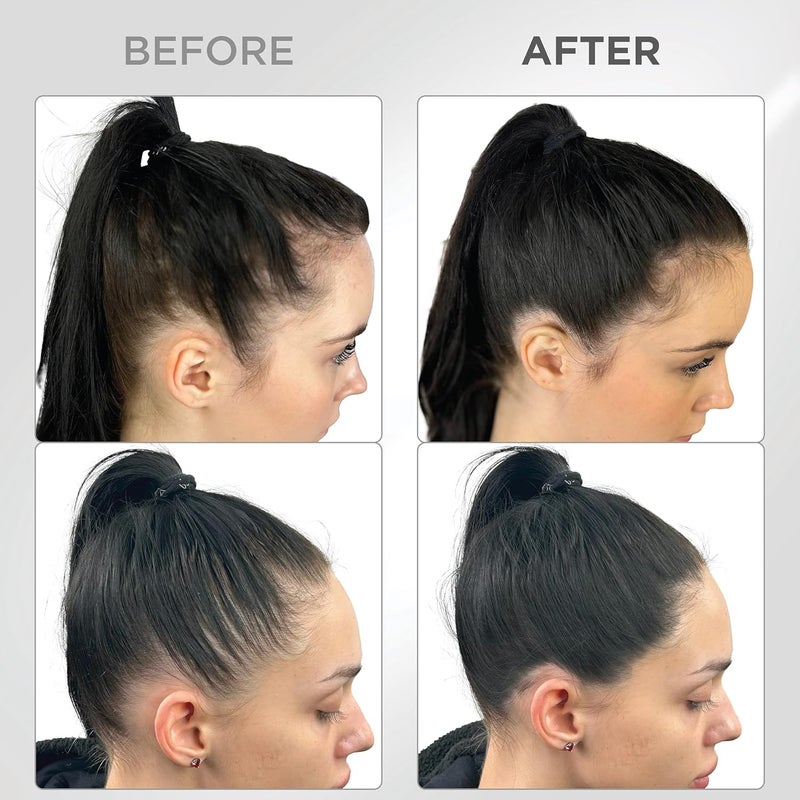 Thick Fiber بودرة تغطية الجذور THICK FIBER لتغطية الرأس الأصلع الرقيق مقاومة للماء والعرق مسحوق شعر للنساء ذوات الشعر الرقيق تشمل فرشاة 4 جرام - Image 5