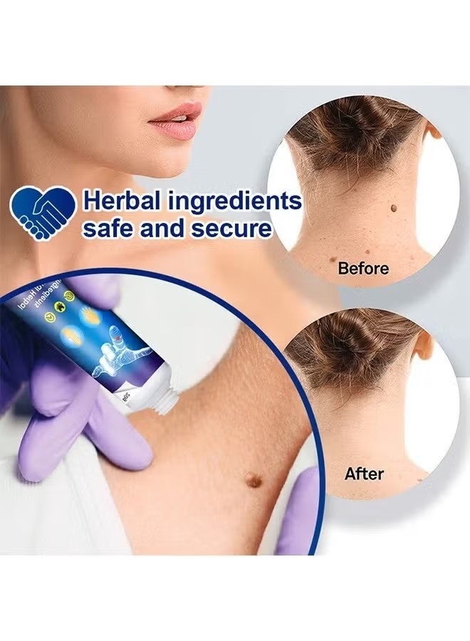 Sumifun Wart Removal Ointment Cream Skin- Treatment With Natural Herbal Ingredients for The Treatment Of Common Warts Effective And Safe - Image 4