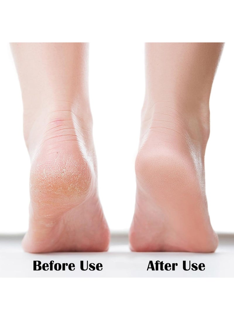 2 PCS Nano Foot File, Foot Scrubber Callus Remover, Foot Care Pedicure Tool,Foot File with Nano-Level Grinding Points, Portable Foot Scrubber for Dead Skin Removal, Cracking, Wet and Dry Feet - Image 3