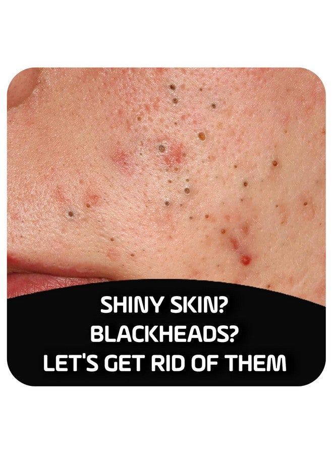 أسيبسيا صابونة علاج حب الشباب أسيبكسيا مع الفحم النشط وحمض الساليسيليك، 4 أونصة - Image 2