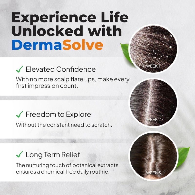 DermaSolve Scalp Psoriasis & Dandruff free Medicated Shampoo with Conditioner, Ultimate Seborrheic Dermatitis Treatment for Itchy, Flakey Scalp, Soothing & Moisturizing Relief - Image 4