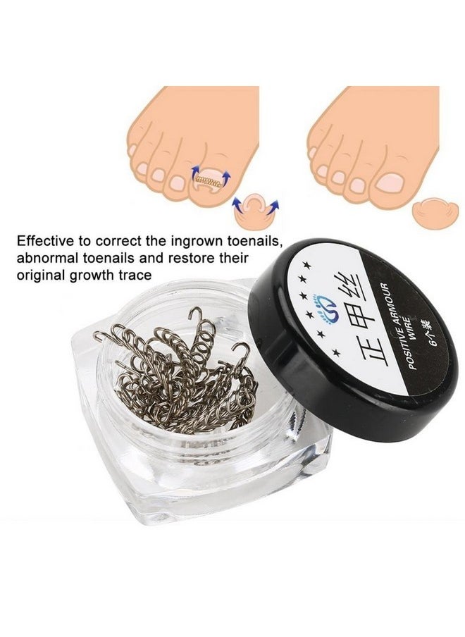 Semme Nail Corrector Pedicure Ment Foot Care Tool, 12Pcs/Box Toenail Correction Tool 6 Sizes Ingrown Wire Fixer Toe Nail Recover Foot Care  - Image 2
