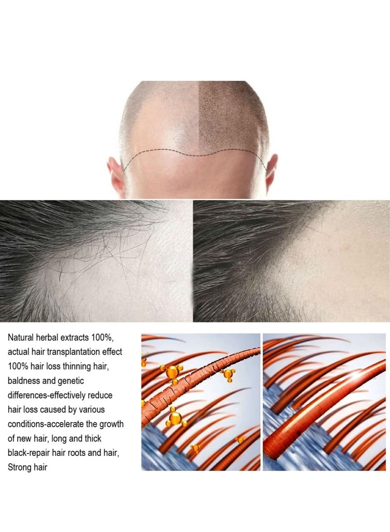 Jaysuing Revitalize Thin Hair with Men's Dense Essential Oil Hair Care Serum - Natural Plant Ingredients for Thicker-Looking Hair - Image 3