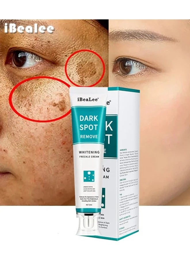 iBealee Dark Spot Remover for Face Peeling Skin Whitening Freckle Cream Pigmentation Treatment Sun Spots Age Spots Blemish Remover Lightening Cream  - Image 1