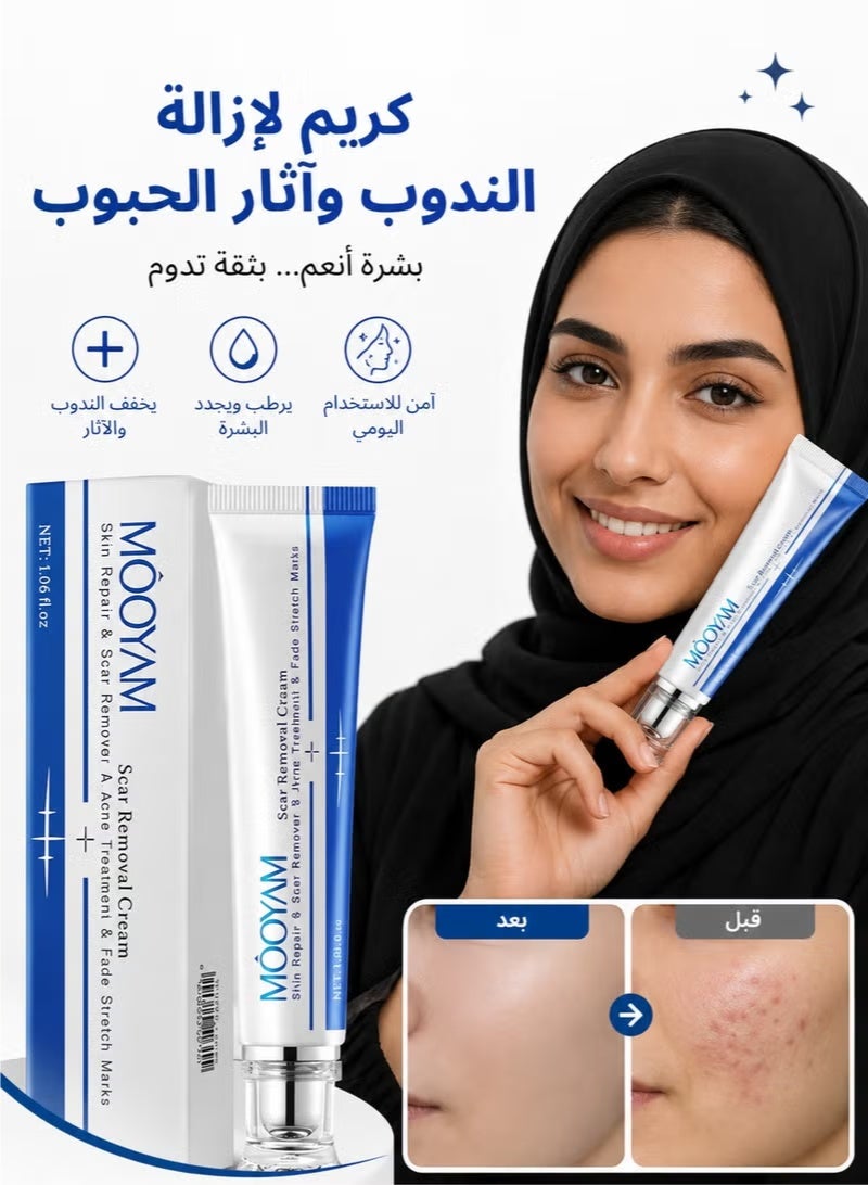 MOOYAM Scar Removal Cream Skin Treatment for Scars Stretch Marks and Acne Marks Improves Skin Texture with Deep Moisturization for All Skin Types - Image 1
