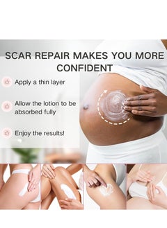 DR.MEINAIER Scar Removal and Stretch Mark Cream, Pregnancy & Anti-Aging Moisturizer for Effective Scar Repair – Silicone Scar Gel (150g) for New and Old Scars, Including C-Section, Stretch Marks  - Image 3