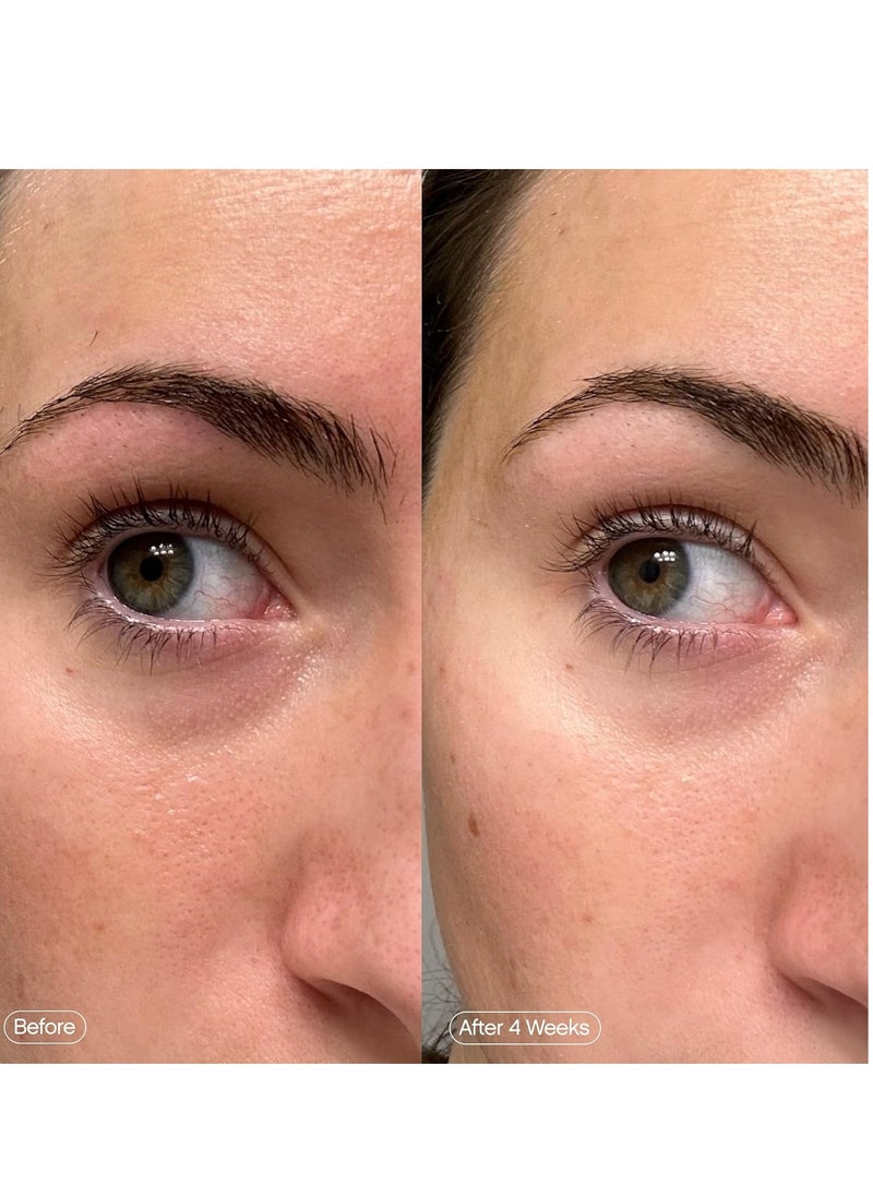 TOPICALS - Topicals Faded Brightening Under Eye Masks | Patches to Depuff, Hydrate, Brighten and Cool | Reduce Dark Circles and Fine Lines | Contains Kojic Acid, Caffeine and Niacinamide (Set of 6) - Packaging may vary - Image 1