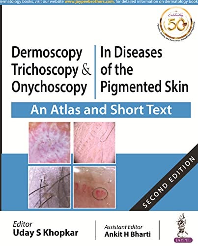 Dermoscopy Trichoscopy And Onychoscopy In Diseases Of The Pigmented Skin An Atlas And Short Text 