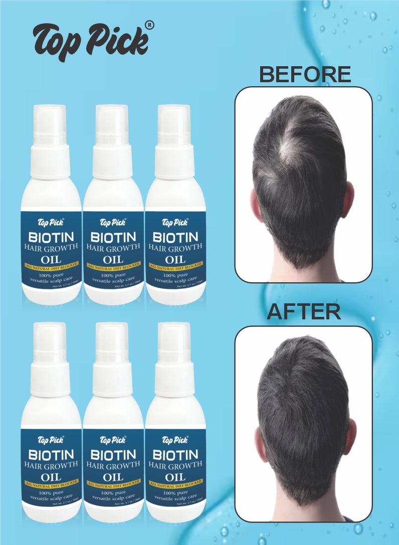 Top Pick Biotin Hair Growth Oil 50ML Benefits Most Types of Hair Healthy Supplement for Hair Strengthen and Best Growth Care All Natural DHT Blocker Pack Of 6