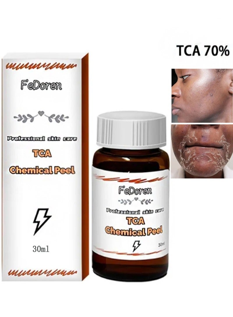 إف إي دورين تقشير كيميائي بحمض ثلاثي كلورو أسيتيك بنسبة 70% لتقشير الوجه، لعلاج حب الشباب، والكلف، والمسام الواسعة، والبشرة الباهتة، والرؤوس السوداء، وتقرن الشعر، تقشير كيميائي لتقشير الوجه في المنزل لعلاج حب الشباب والبقع الداكنة والتجاعيد - 30 مل - Image 1