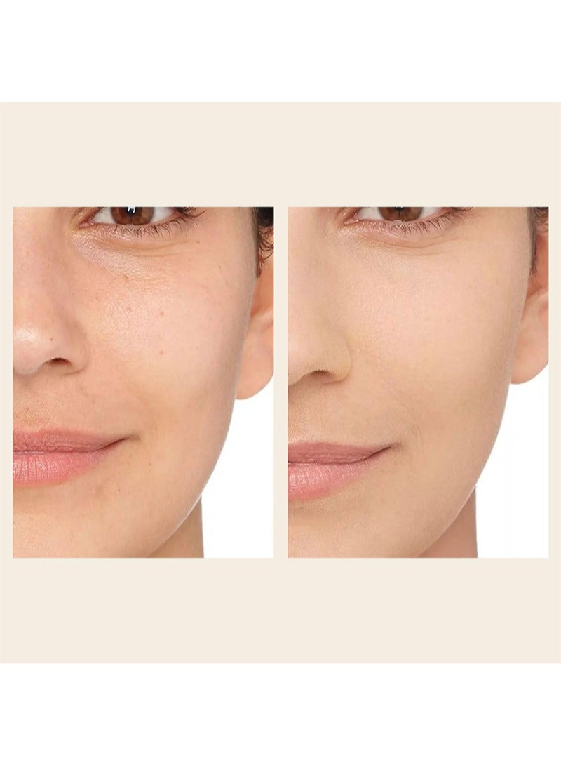 إف إي دورين تقشير كيميائي بحمض ثلاثي كلورو أسيتيك بنسبة 70% لتقشير الوجه، لعلاج حب الشباب، والكلف، والمسام الواسعة، والبشرة الباهتة، والرؤوس السوداء، وتقرن الشعر، تقشير كيميائي لتقشير الوجه في المنزل لعلاج حب الشباب والبقع الداكنة والتجاعيد - 30 مل - Image 2