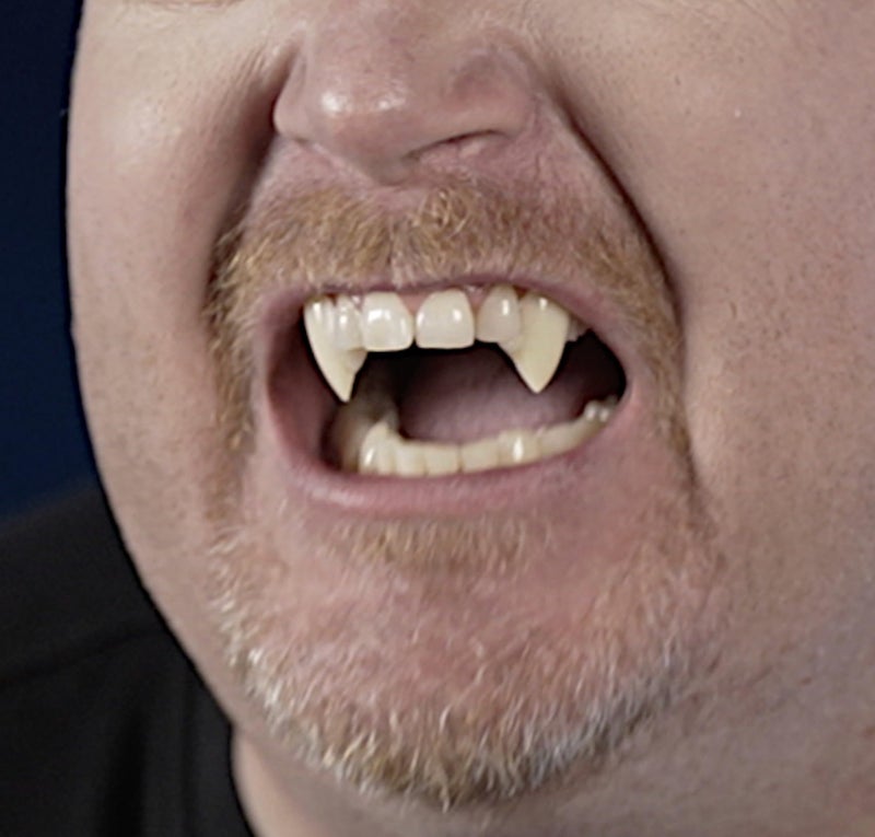 Gothika Professional Custom Fit Natural 18mm Vampire Fangs - Custom Fits to Your Teeth in 10 Minutes - No Adhesive Required - Realistic Look and Color - Image 2