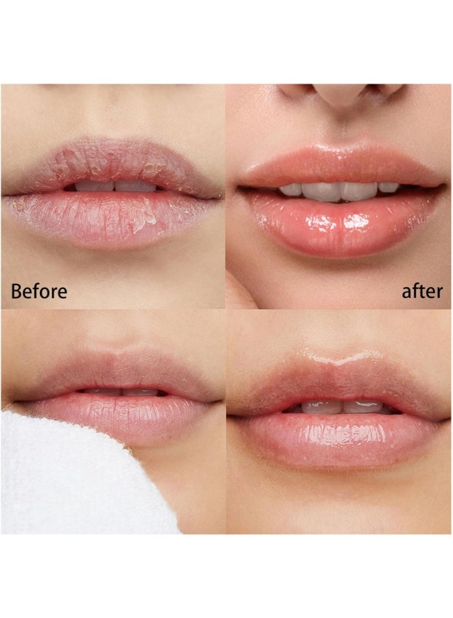 SADOER Lip Mask, Pink Anti-Cracking and Hydrating Lip Balm 10g - Image 3