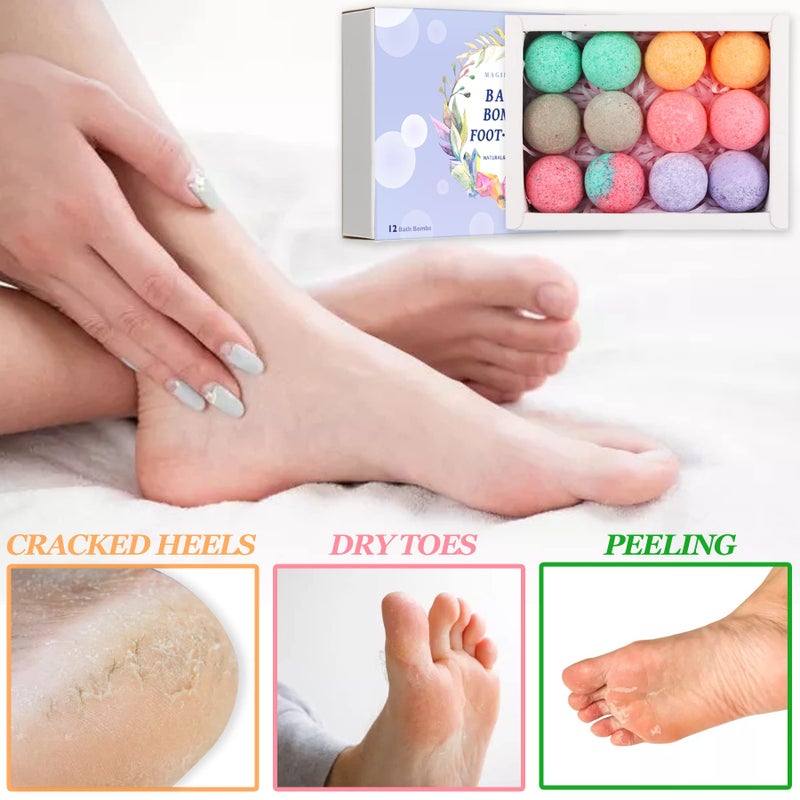 MAGIHERBE Foot Bath Bombs 12 Pack,Organic Foot Soak with Bath Salt,Foot Spa Bomb Rich Essential Oils for Dry Cracked, Athletes Foot, Stubborn Foot Odor Scent,Tired Sore Feet - Image 2