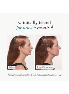 NUTRAFOL Women's Balance Hair Growth Supplement with Collagen Peptides, Ages 45+, Clinically Tested for Stronger, Visibly Thicker Hair, Dermatologist Recommended - 1 Month Supply, 12 oz Bottle  - Image 4