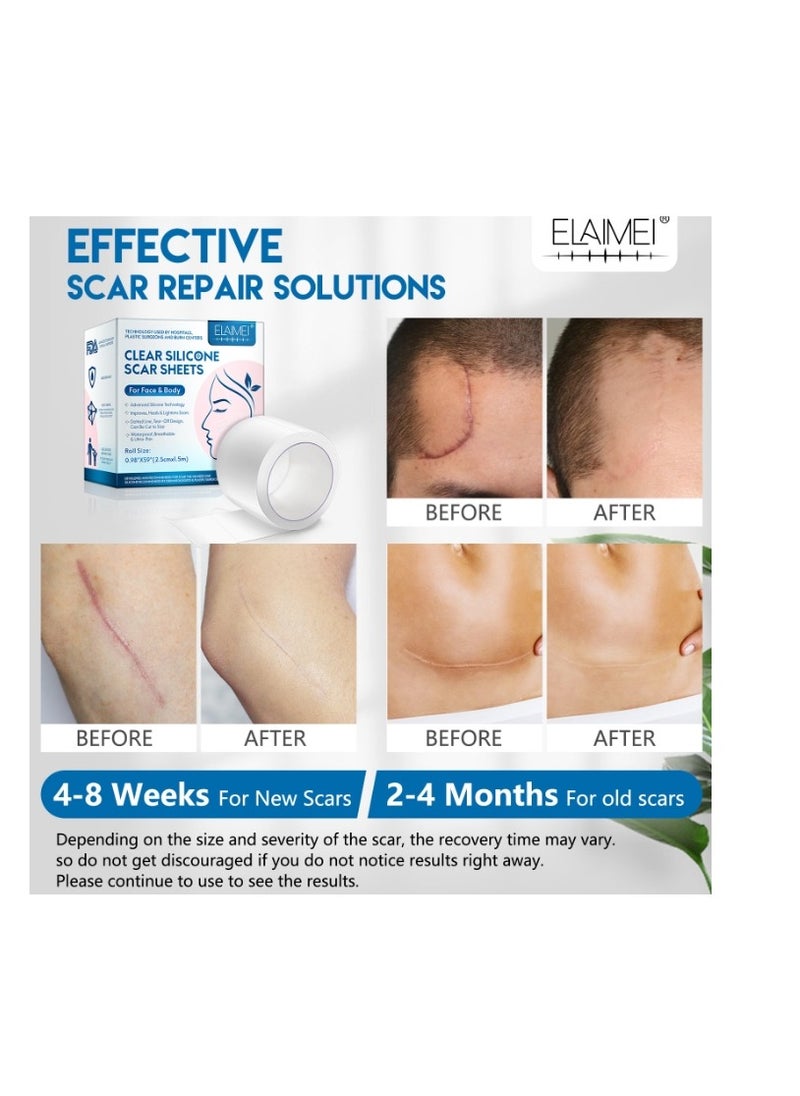 Elaimei Medical Grade Silicone Scar Sheets Roll Tape Keloid C-Section Surgical Scars Removal Treatment Silicon Gel Cream Patch Bandage Removes Abs Tuck Surgery Scars  - Image 2