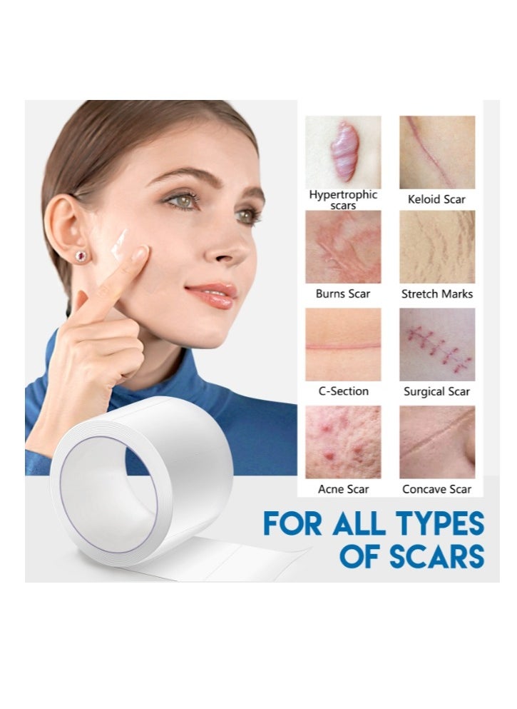 Elaimei Medical Grade Silicone Scar Sheets Roll Tape Keloid C-Section Surgical Scars Removal Treatment Silicon Gel Cream Patch Bandage Removes Abs Tuck Surgery Scars  - Image 3
