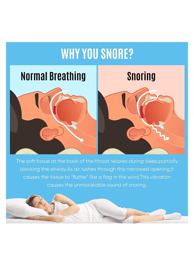 Healthy Anti-snoring Mask, anti-snoring device to help stop snoring, snoring reduction solution, comfortable and adjustable for men/women. Give people a good night's sleep  - Image 3