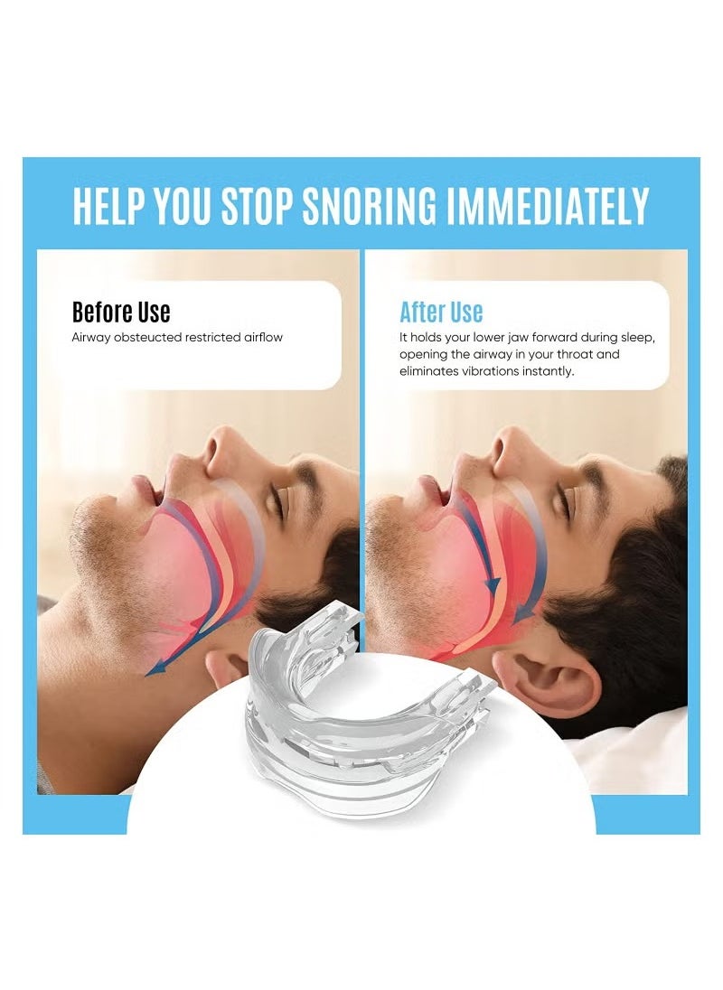 Healthy - Anti-snoring Mask, anti-snoring device to help stop snoring, snoring reduction solution, comfortable and adjustable for men/women. Give people a good night's sleep - Image 1