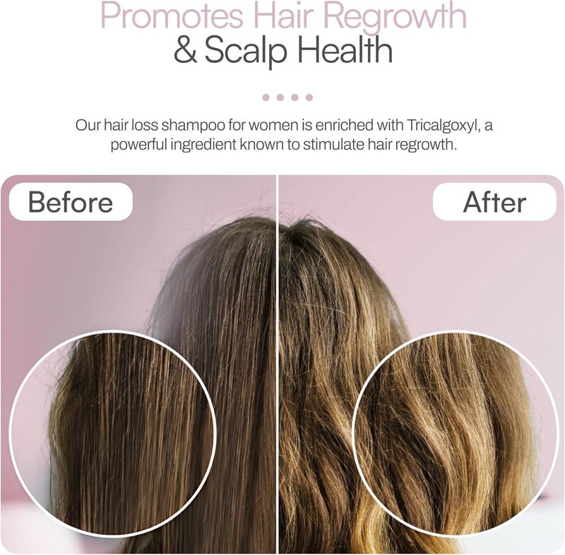 Foltene Shampoo Strengthening For Thinning Hair Women 200ml - Image 4