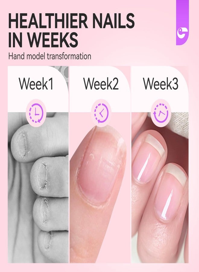 gelike ec Nail Biting Prevention for Adults and Kids - Gelike EC Bitter Taste Stop Nails Biting Treatment for Toddler 2-9+ Thumb Sucking Deterrent - Easy and Quickly Stop Nail-biting Habit with Safe Solution - Image 4