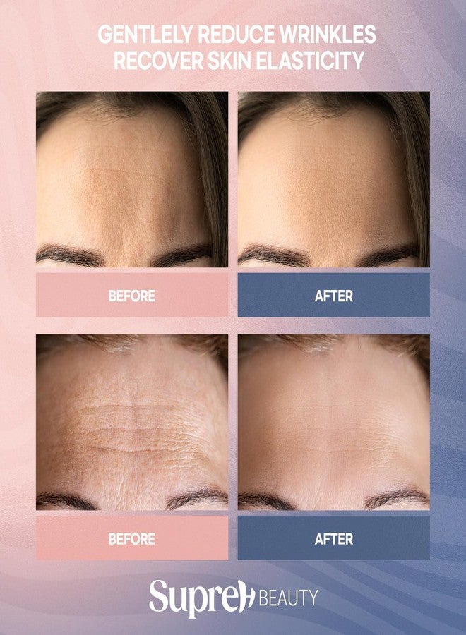 SupreH Forehead Wrinkle Patches For Anti-Wrinkle: Facial Wrinkle Patches for Forehead Fine Lines Frown Lines - Overnight Mask 13 Patch - Image 4