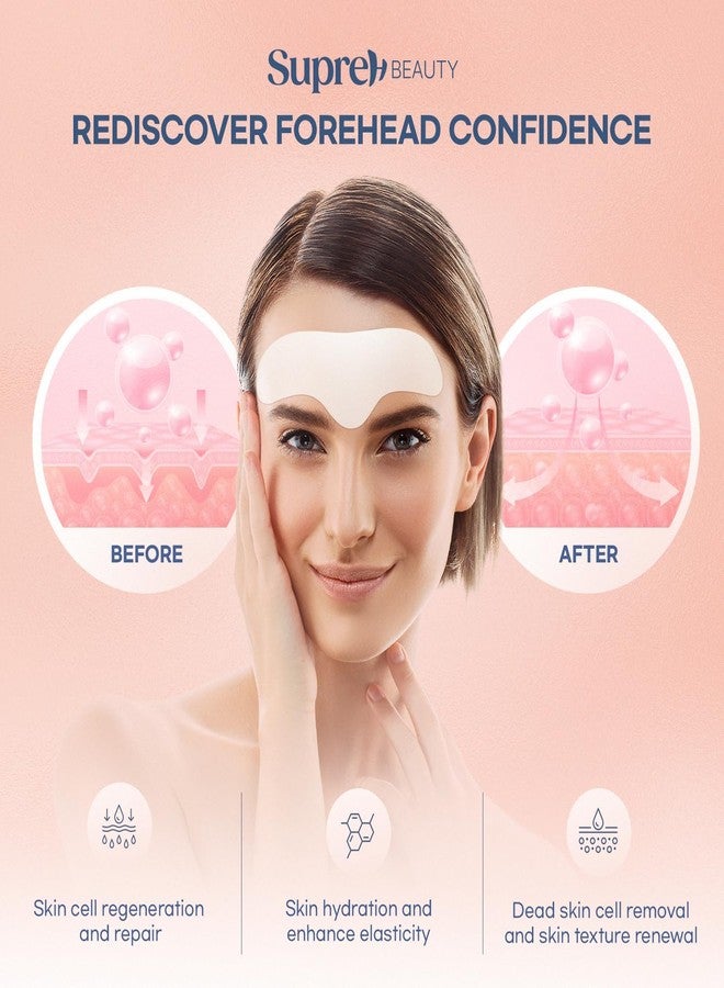 SupreH Forehead Wrinkle Patches For Anti-Wrinkle: Facial Wrinkle Patches for Forehead Fine Lines Frown Lines - Overnight Mask 13 Patch - Image 3