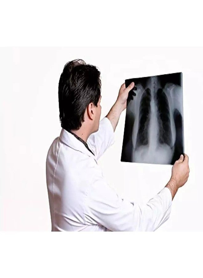 GMP Inkjet Medical Blue Film For X-Ray, CR, DR imaging/Waterproof Film/SIZE: A4 (210mm x 297mm 100 Sheet Pack of 280 GSM / 210 Micron compatible with Canon, Epson,Brother,HP Printers - Image 4