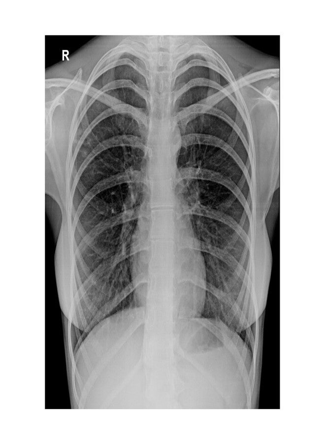 GMP Inkjet Medical Blue Film For X-Ray, CR, DR imaging/Waterproof Film/SIZE: A4 (210mm x 297mm 100 Sheet Pack of 280 GSM / 210 Micron compatible with Canon, Epson,Brother,HP Printers - Image 5