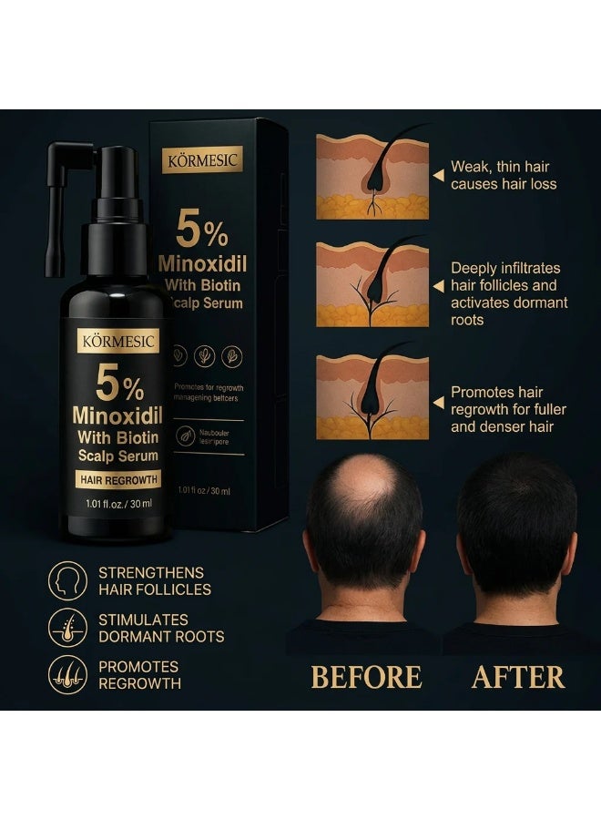 Kormesic Premium Hair Regrowth Solution with 5% Minoxidil Biotin Scalp Care A powerful combination of Minoxidil and Biotin helps nourish the scalp, support healthy follicle function, and encourage visible hair growth. Perfect for individuals experiencing hair thinning and hair loss concerns. - Image 4