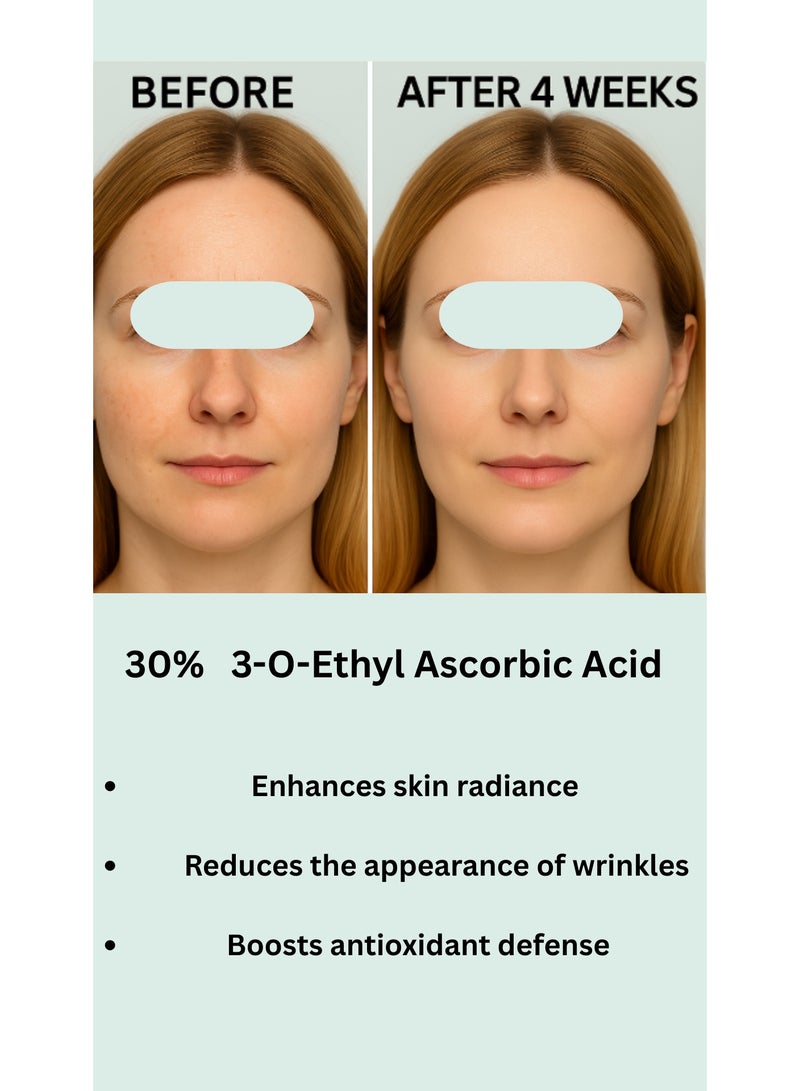 BONITTO® BONITTO – C-Glow Rejuvenating Serum with 30% Vitamin C (3-O-Ethyl Ascorbic Acid) – 30ml - Image 4