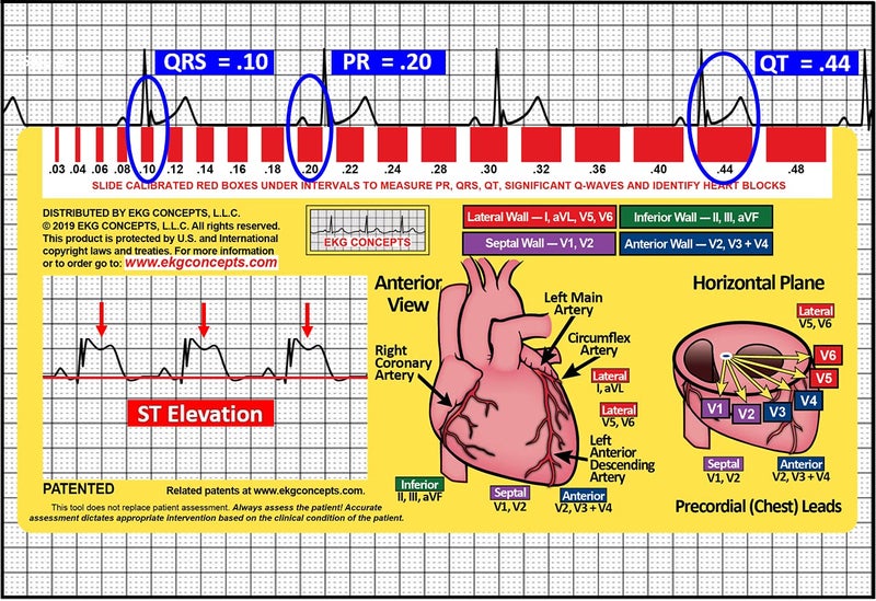 R-Cat نافذة R-CAT EKG الطبعة الثانية - Image 4