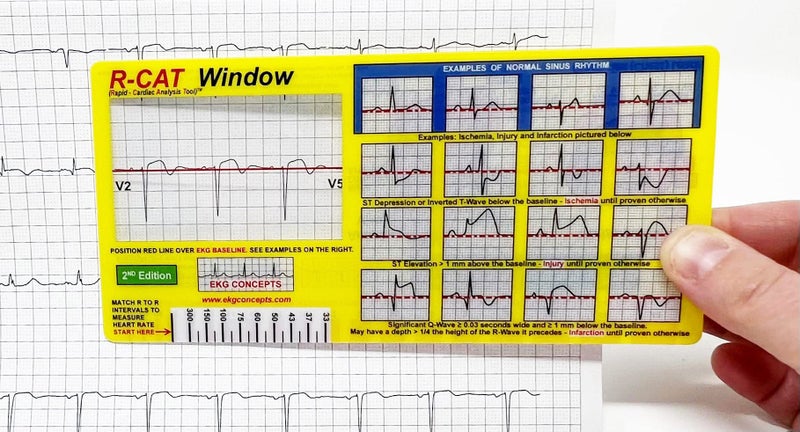 R-Cat نافذة R-CAT EKG الطبعة الثانية - Image 2