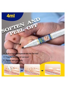 ERAYCEE Tags & Moles Remover Pen For Face Body, Mole Remover Fast Easy Effective Easy To Remove Tags, Moles, Warts 1Pc 4 ml  - Image 2