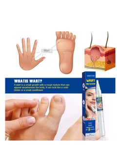 ERAYCEE Tags & Moles Remover Pen For Face Body, Mole Remover Fast Easy Effective Easy To Remove Tags, Moles, Warts 1Pc 4 ml  - Image 3