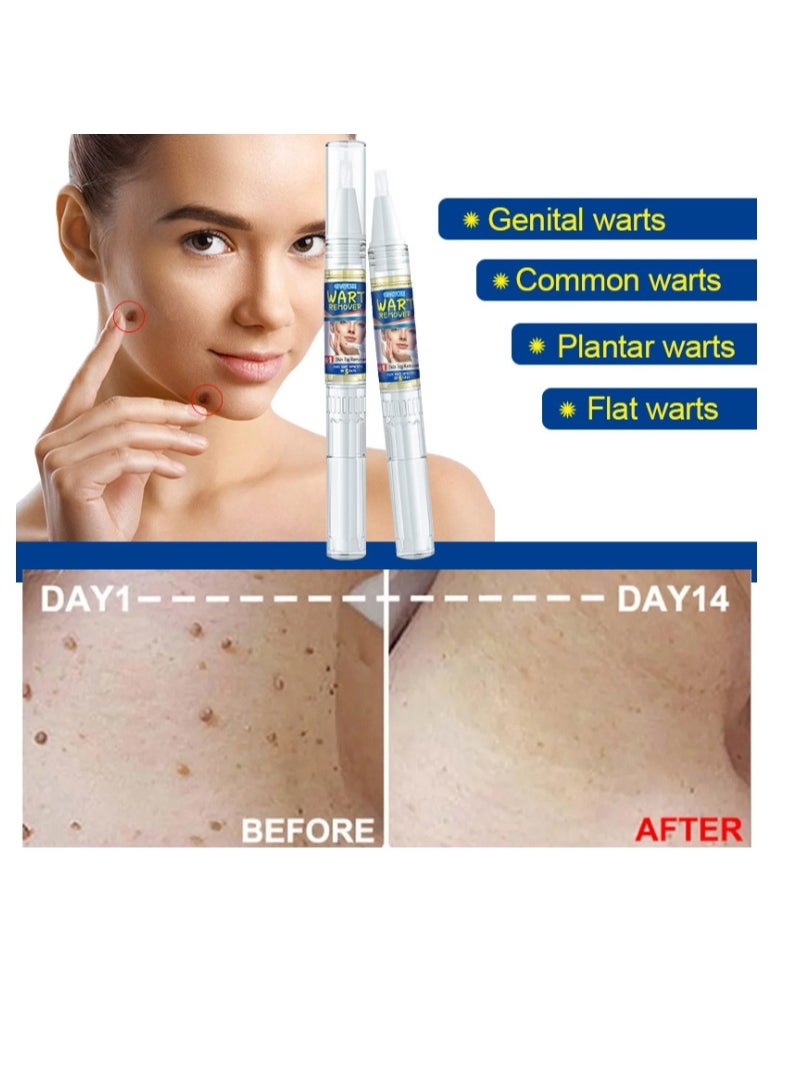 ERAYCEE Tags & Moles Remover Pen For Face Body, Mole Remover Fast Easy Effective Easy To Remove Tags, Moles, Warts 1Pc 4 ml  - Image 4