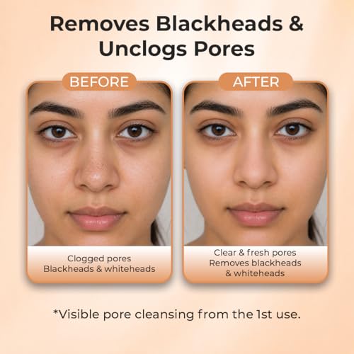Sanfe Deep Purifying Nose Strips for Women - Pack of 3 with Fuji Green Tea & Witch Hazel extracts | Removes Whiteheads | Blackheads and cleanses pores | Use on Nose - Image 2