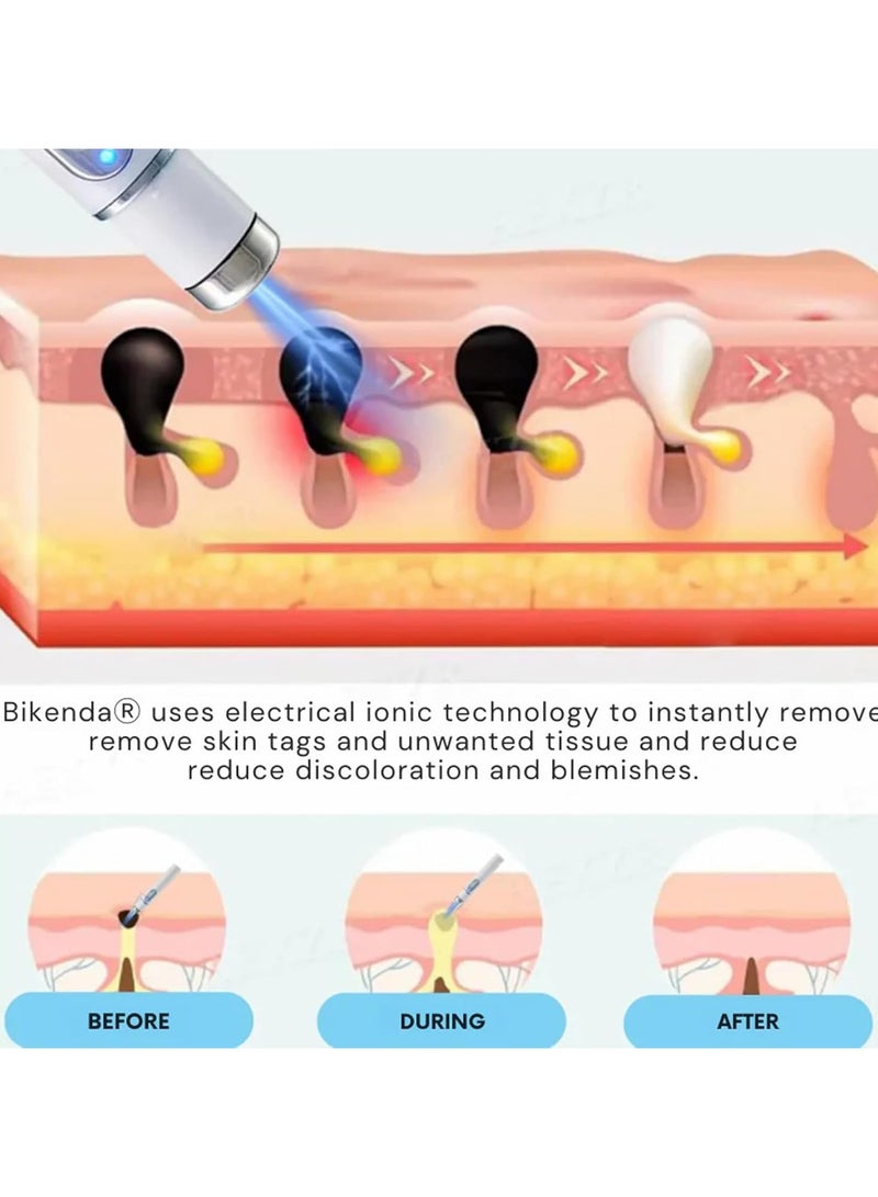 ATRJSZ Mole and Wart Removal Pen, Non-Invasive Mole and Wart Removal, 2025 Upgrade New Skin Tag Removal Pen, Smoothes and Reduces Blemishes,Suitable for All Types  - Image 3