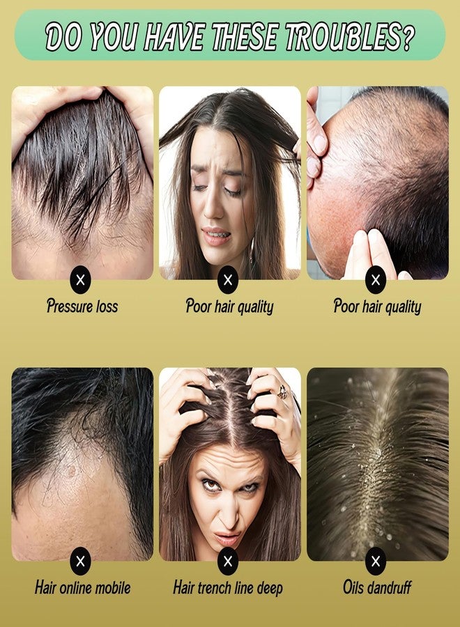 Rednow Ginger Plant Extract Hair Shampoo, Polygonum Multiflorum Hair Care, Strengthening, Thickening Shampoo for Women Men (3PCS, 240ML) - Image 2