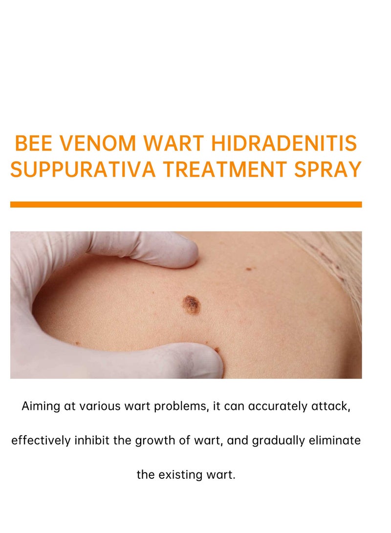 BOOMOON Bee Venom Treatment Repair Spray, Advanced Wart Treatment Spray For All Wart Types,A Gentle Safe Portable Wart Removal Spray with Natural Extracts，Protecting Health and Beauty 20ml - Image 3