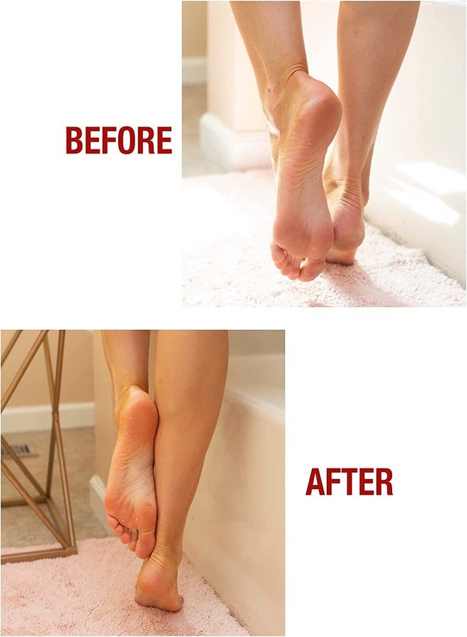 Kerasal Intensive Foot Repair Skin Healing Ointment,1 Oz and Moisturizing Gel Socks,(Packaging May Vary),(Pack of 4) - Image 4