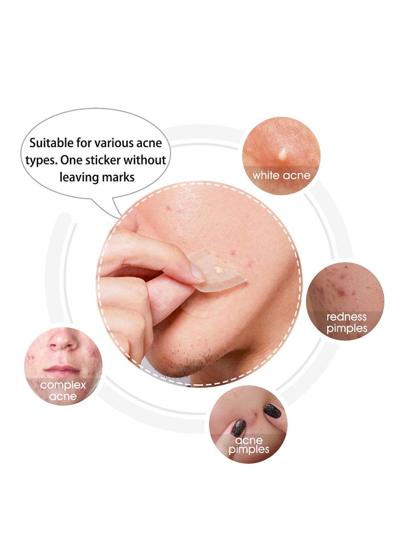 Elaimei - 20 Pcs Acne Patches (Crescent-Shaped Patches) Hydrocolloid + Tea Tree Oil Quick Healing Ultra Thin Patches Hydrocolloid & Tea Tree Oil Infused Acne Removing Patches Unisex - Image 1