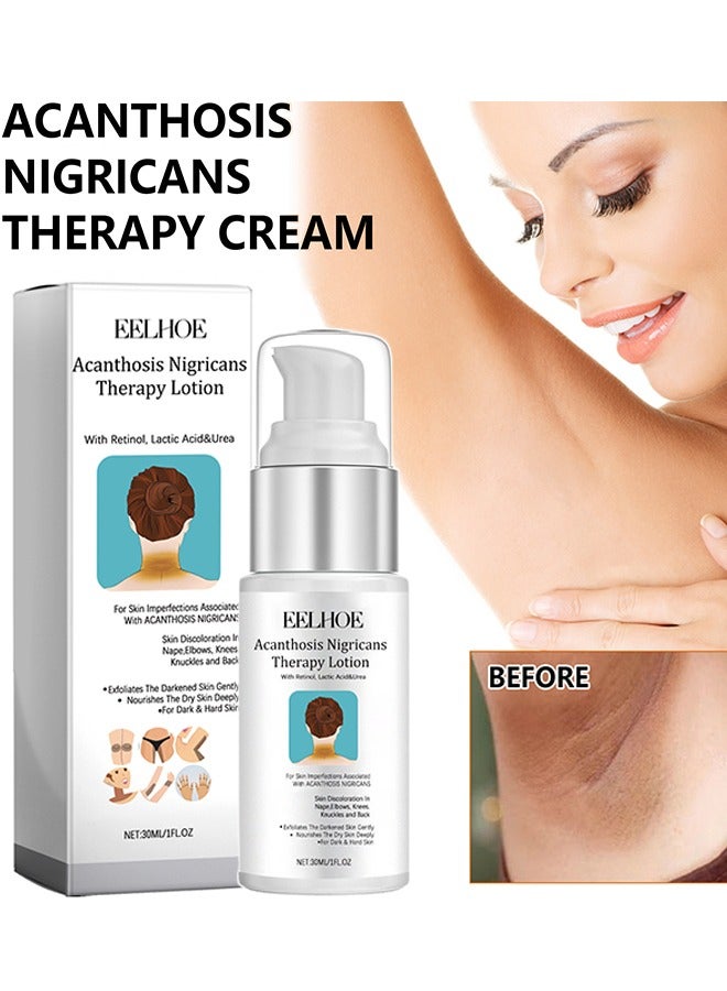 EELHOE Acanthosis Nigricans Therapy Lotion - with Lactic Acid ,Dermatologist Tested Retinol Lotion, Hyperpigmentation Removal Lotion, For Dark Body Parts like Neck Ankles Knuckles Armpits 30ml - Image 1