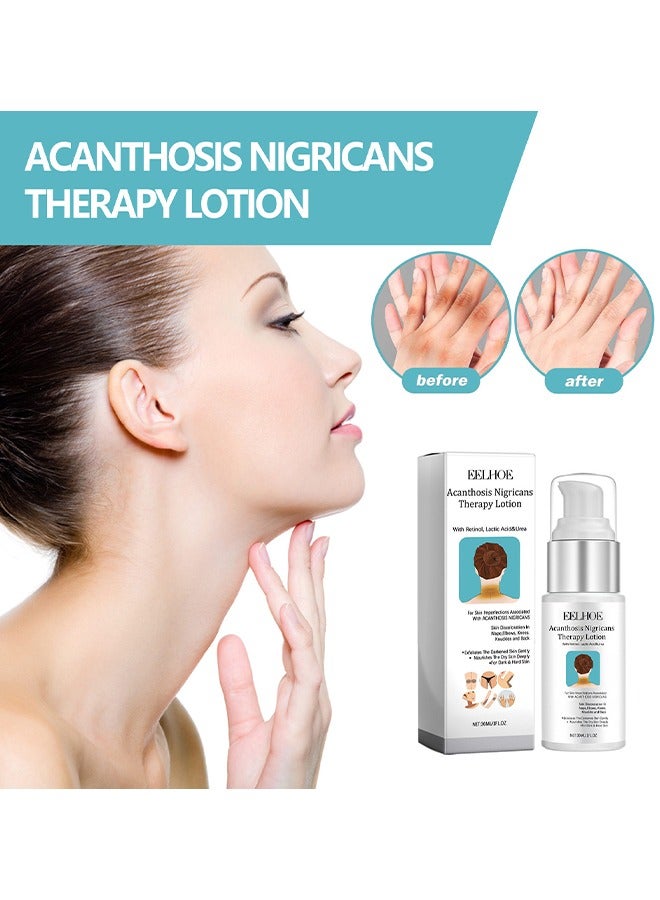 EELHOE Acanthosis Nigricans Therapy Lotion - with Lactic Acid ,Dermatologist Tested Retinol Lotion, Hyperpigmentation Removal Lotion, For Dark Body Parts like Neck Ankles Knuckles Armpits 30ml - Image 2