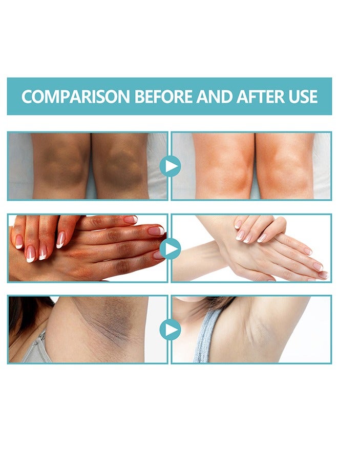 EELHOE Acanthosis Nigricans Therapy Lotion - with Lactic Acid ,Dermatologist Tested Retinol Lotion, Hyperpigmentation Removal Lotion, For Dark Body Parts like Neck Ankles Knuckles Armpits 30ml - Image 5